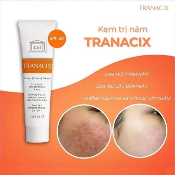 Kem dưỡng mờ nám da Tranacix Cream Dr Da liễu của bạn