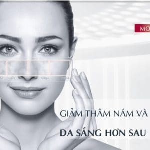 Resum trị thâm nám, tàn nhang Eucerin Ultra White Spotless