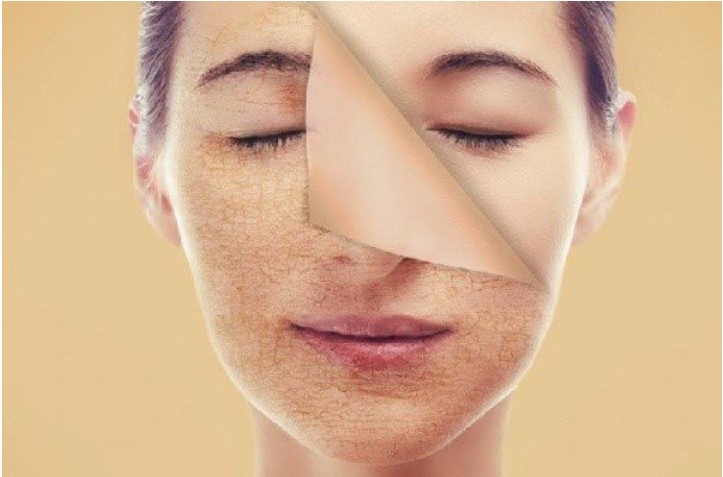 Làn da sẽ khô sạm khi sừ dụng các sản phẩm sữa rửa mặt không chất lượng