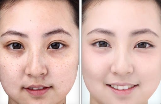 kem trị nám obagi nuderm 3 clear