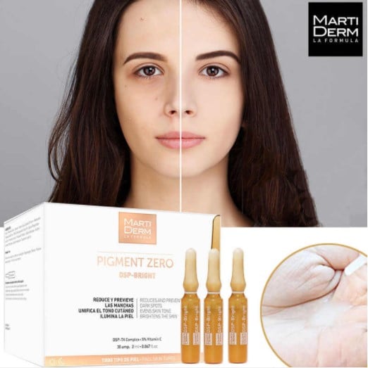 Hiệu quả sử dụng MartiDerm Pigment Zero DSP Bright