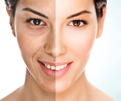 Viên uống Labcos khắc phục tình trạng da thiếu hụt collagen