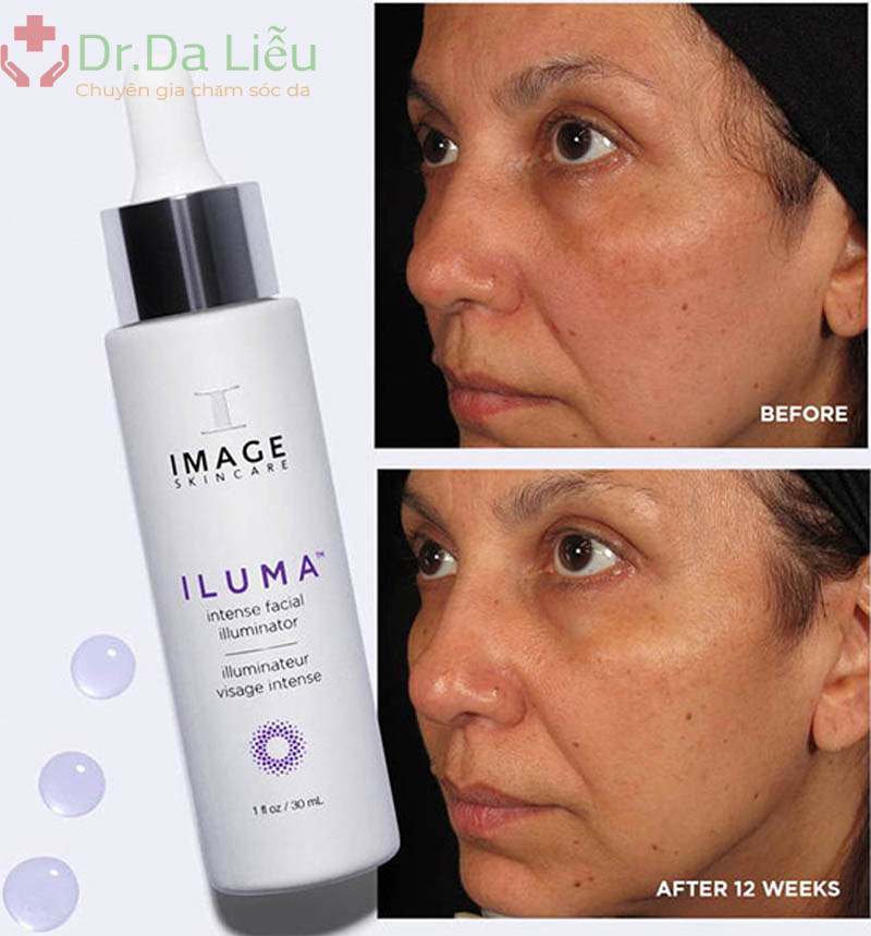 ILUMA Intense Facial Illuminator