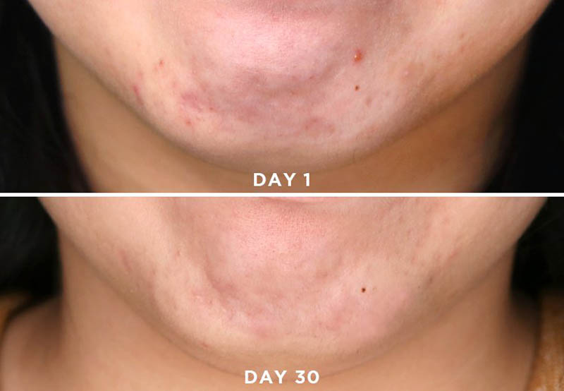 Paula choise Discoloration Repair Serum chứa niacinamide