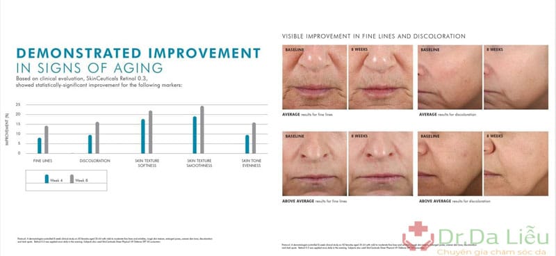 review Skinceuticals Retinol 1.0