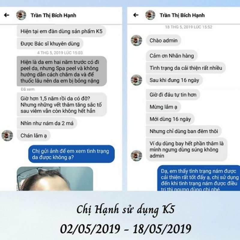 Kem k5 giá bao nhiêu