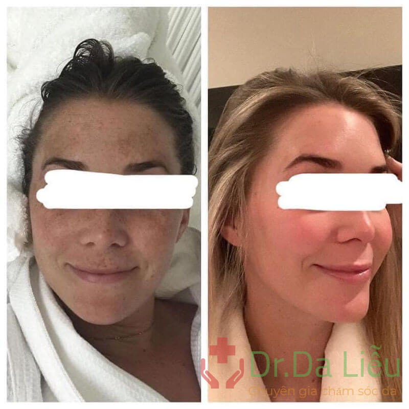 skinceuticals discoloration defense