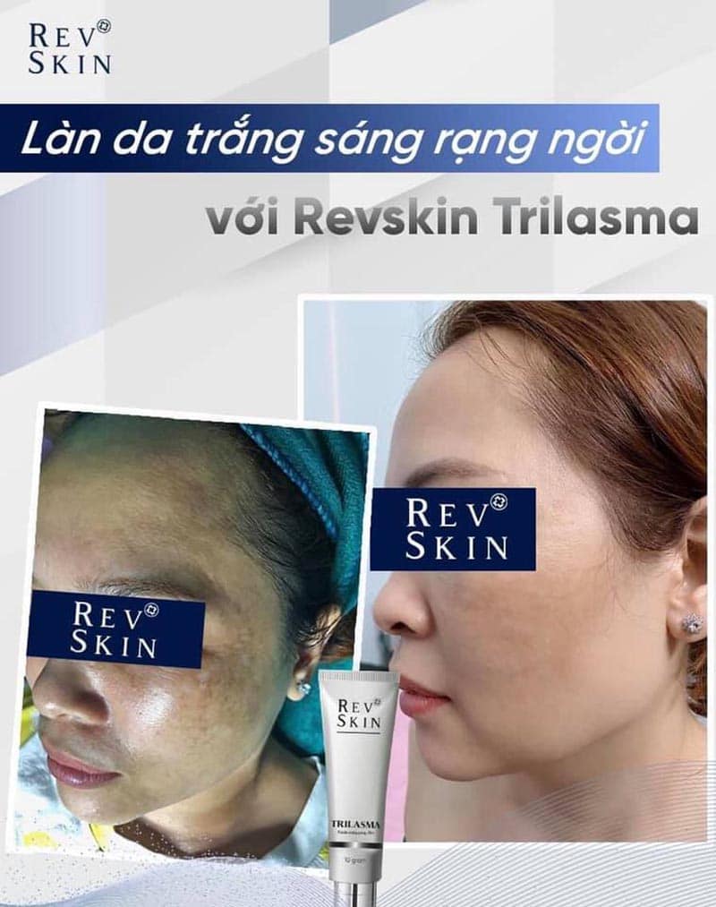 Kem tri nam RevSkin Trilasma