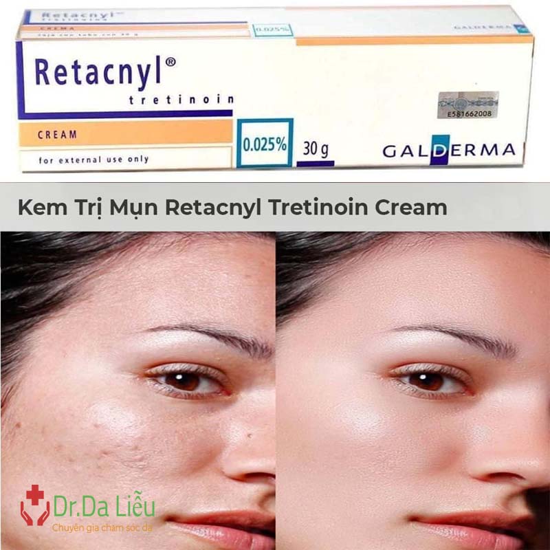 Retacnyl 0.025 có tốt không