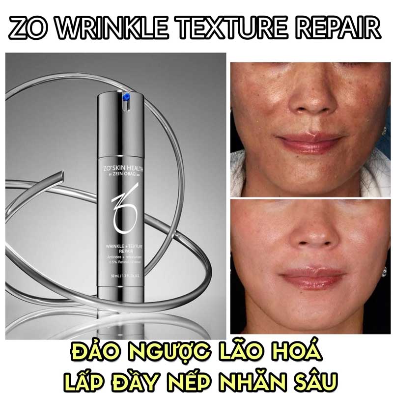zo wrinkle texture repair có tốt không