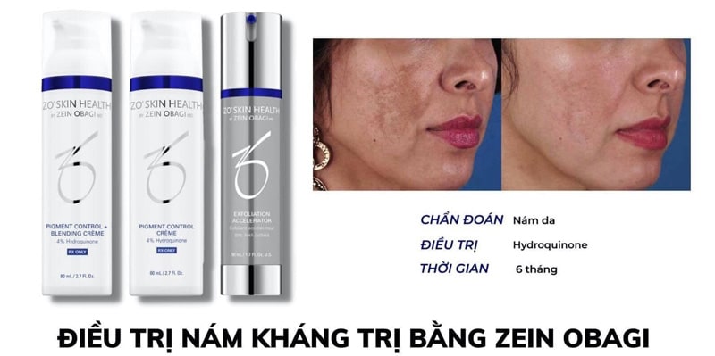 zo pigment control cream