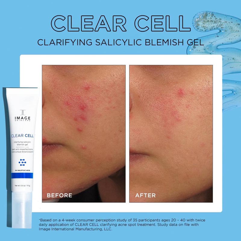 Gel chấm mụn Image Clear Cell
