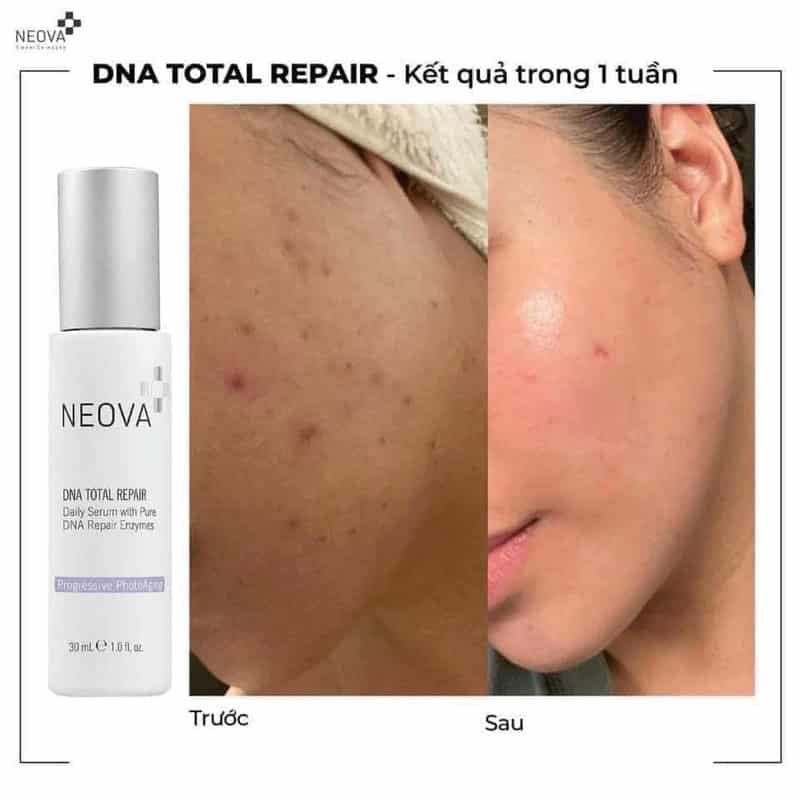 Neova DNA Total Repair