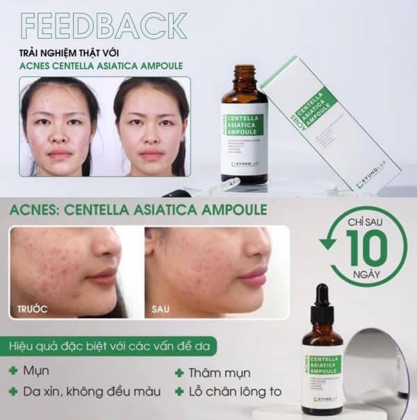 Serum trị mụn Kyung Lab