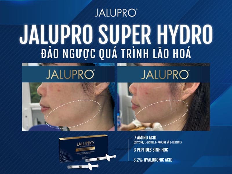 Super Hydro Jalupro