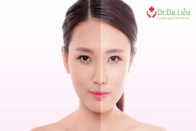 Sử dụng các viên uống hỗ trợ trắng da