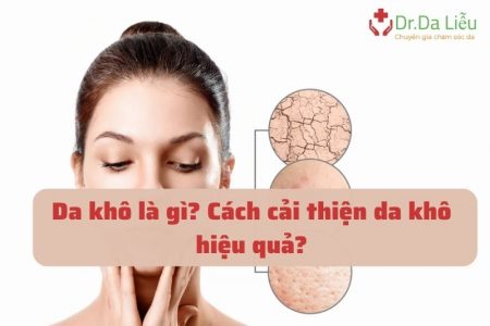 Nguyên nhân và đặc điểm nhận biết da khôv