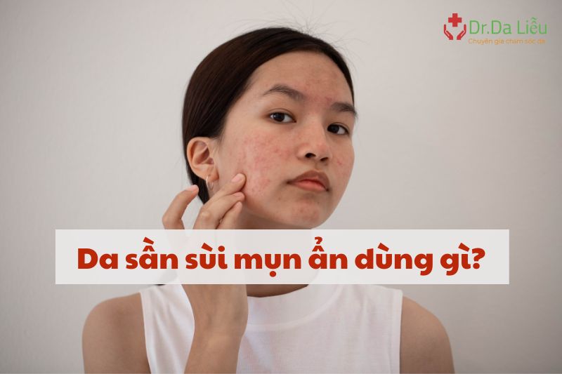 Da sần sùi mụn ẩn dùng gì?