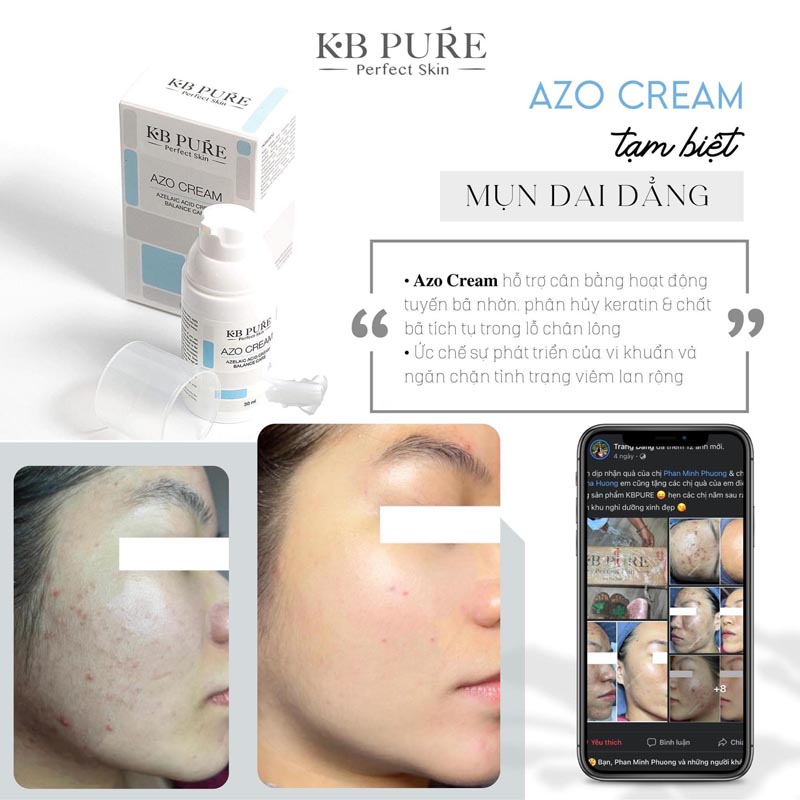 Kb Pure Azo Cream