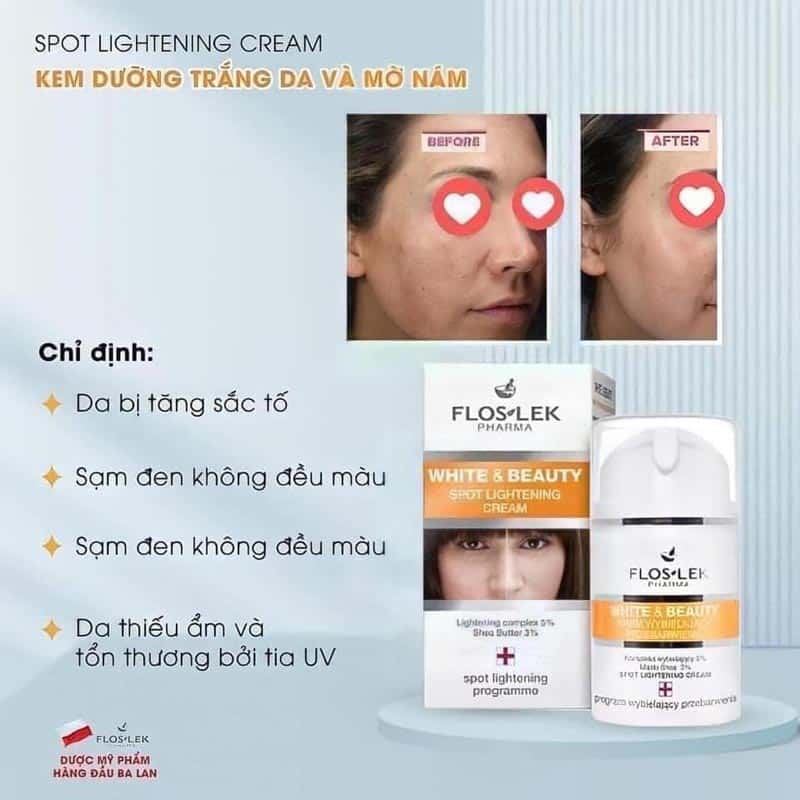 Kem trị nám Floslek