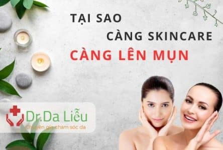 Tại sao càng skincare lại càng lên mụn