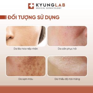 công dụng serum pdrn kyunglab