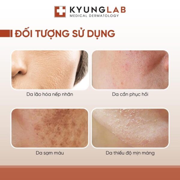 công dụng serum pdrn kyunglab