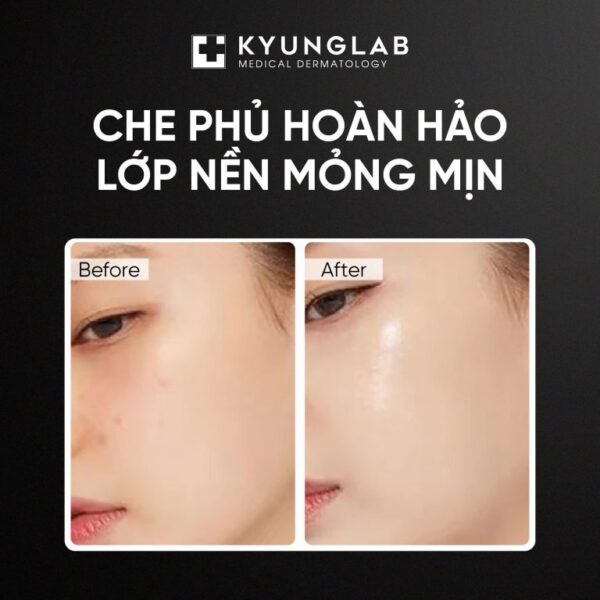 cushion kyunglab moi