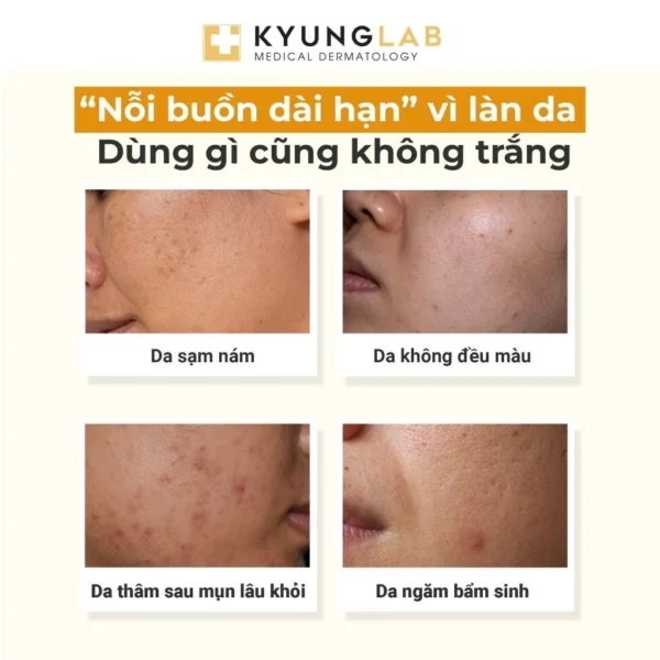 trx kyunglab sang da
