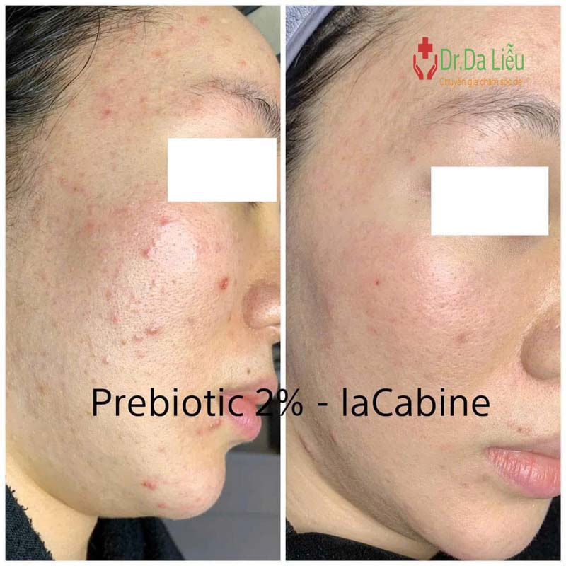 LaCabine 2% Prebiotic Complex oil free