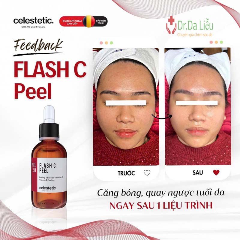 Flash C Peel Celestetic
